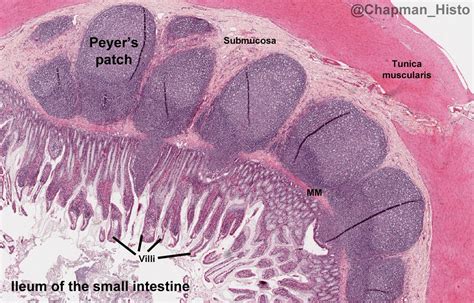 Ileum Histology Labeled Peyers Patches