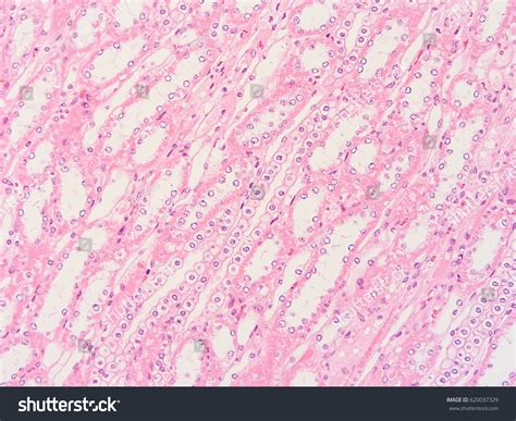 Histology Human Intestine Show Epithelium Tissue Foto stock 620037329 | Shutterstock