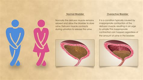 Overactive Bladder - Scientific Animations