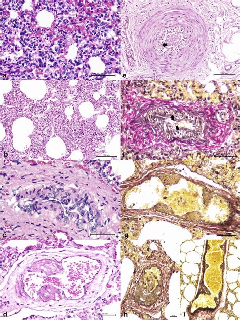 Histopathological and histochemical findings observed in cattle during... | Download Scientific ...