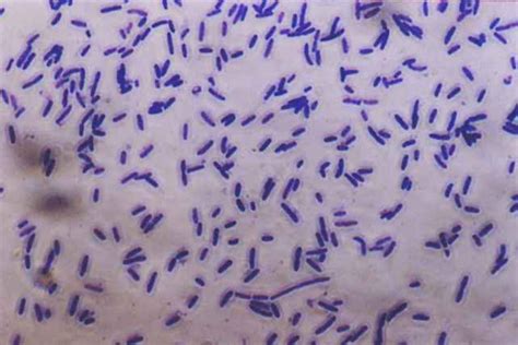 The Simple Stains - Microbiology learning: The "why"ology of microbial testing