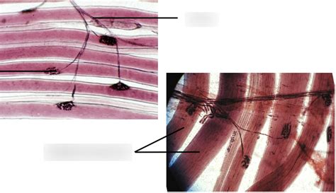 Histology slide - Motor end plate Diagram | Quizlet