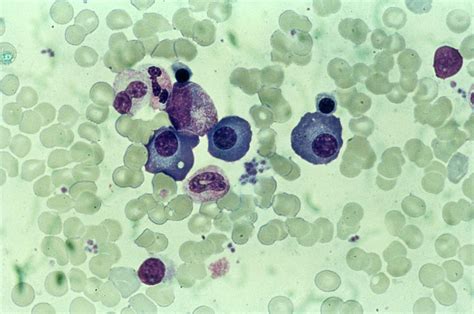 Lm Of A Blood Smear Showing White Blood Cells Photograph by Biophoto Associates/science Photo ...