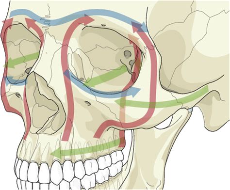 Maxillofacial and Mandibular Fractures in Sports - Clinics in Sports Medicine