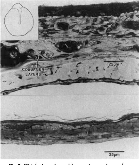 Figure 1 from Comparative Histology of the Tympanic Membrane and its ...