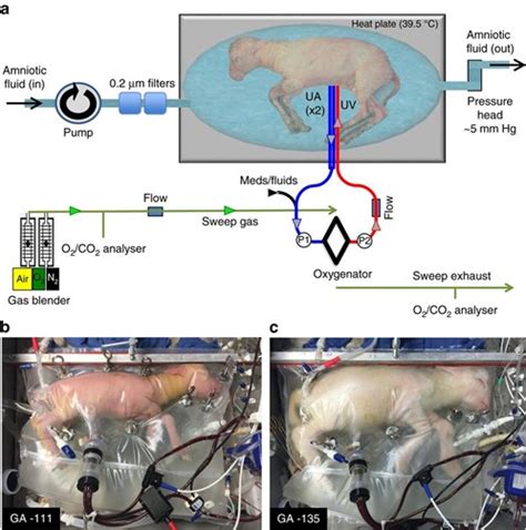 Artificial Womb Research Rapidly Advances as Birth Rates & Fertility Dramatically Decline » Sons ...