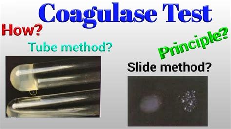 Coagulase Test - YouTube