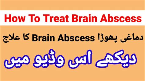 Brain Abscess: treatment and management - YouTube