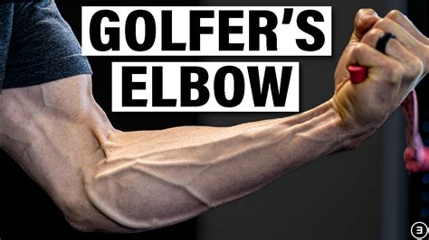 Golfer’s Elbow - E3 Rehab