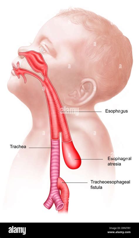 Trachea and esophagus hi-res stock photography and images - Alamy