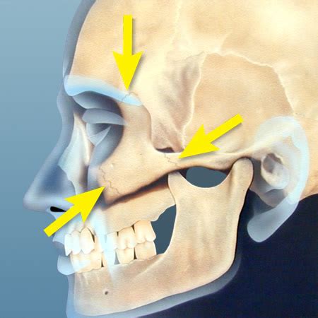 Zygomatic Process