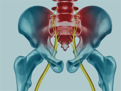 Best Blog Everything You Should Know About Sciatica 2022 | KLM GROUP 2022