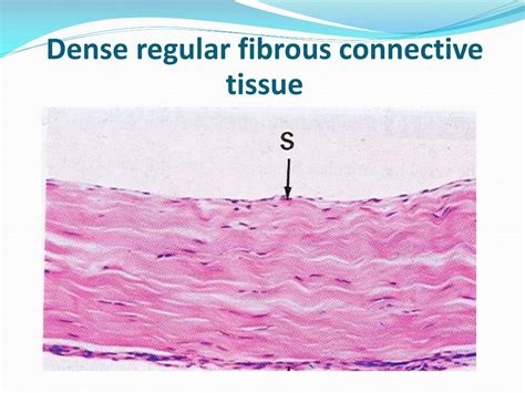 PPT - Connective tissue PowerPoint Presentation, free download - ID:4010374