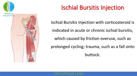 Orthopedic Procedures In Orthopedic Surgery From A To Z