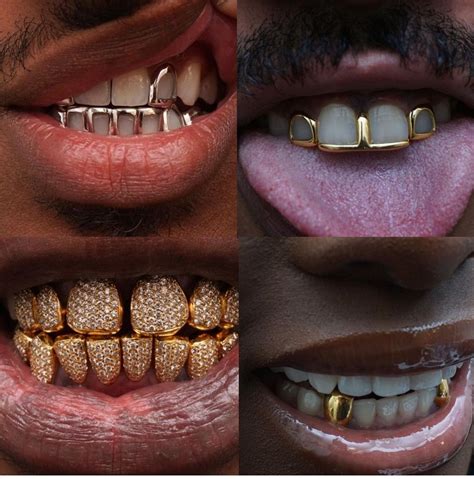 What Karat Of Gold Is Used For Teeth - Nina Mickens Hochzeitstorte