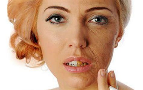 Effects of Smoking on Skin, Does Quitting Smoking help Skin, Smoker’s Skin Repair, Pictures