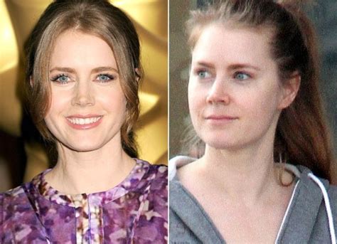 Amy Adams' Plastic Surgery: Did the Cast of "The Enchanted" Have Botox ...