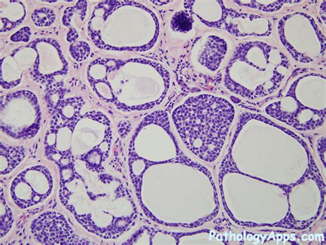 Adenoid Histology