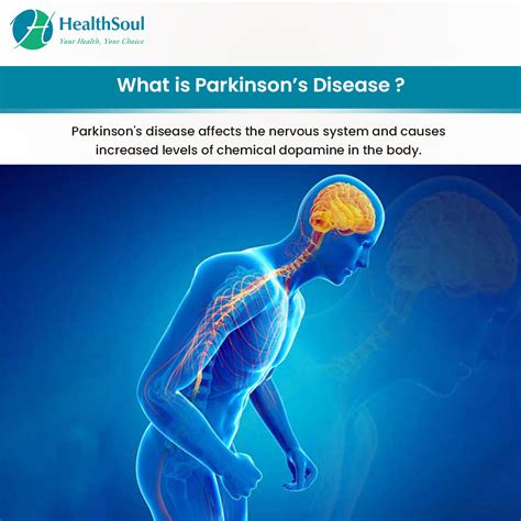 Parkinson’s Disease: Symptoms, Diagnosis and Treatment – Healthsoul