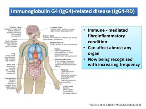 IgG4-related disease