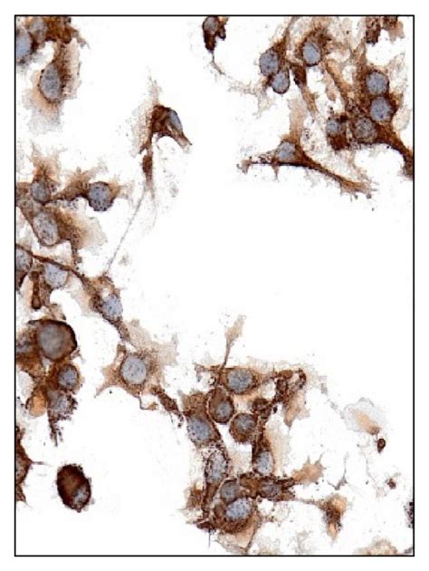 The diagram shows cellular uptake of iron by internalizing the... | Download Scientific Diagram