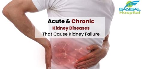 kidney diseases that cause kidney failure - Bansal Hospital