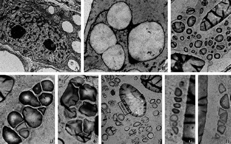 Structures of starch granules in endosperm cells with GA-OsO 4 fixation... | Download Scientific ...