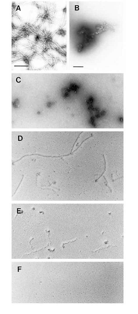 Electron microscopy of uranyl acetate-stained (A-C) and rotary shadowed... | Download Scientific ...