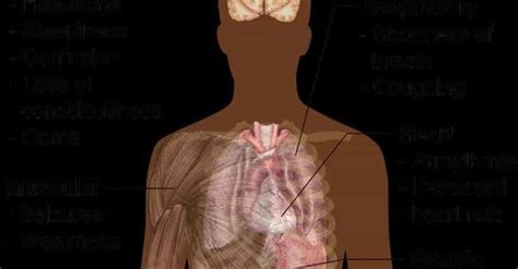 Perinatal Asphyxia Symptoms | List of Signs of Perinatal Asphyxia