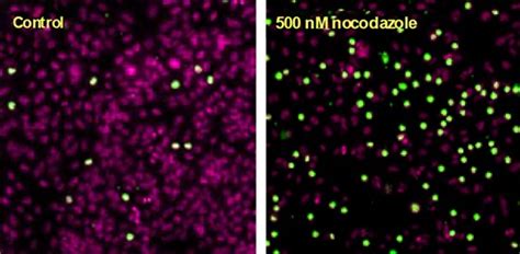 HCS Cell Cycle Assay | Thermo Fisher Scientific - UK