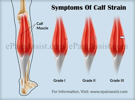 The 25+ best Calf muscle strain ideas on Pinterest | Exercise for saddlebags, Tight thighs and ...