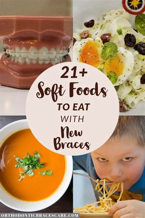 Soft Foods To Eat After Braces Tightening [With List] - Orthodontic ...