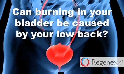 Interstitial Cystitis? Your Bladder Pain May Be Your Low Back