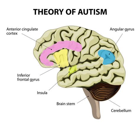 Autism Brain Cartoon