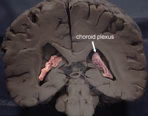 Plexos coroideos [Neurocirugía Contemporánea ISSN 1988-2661]