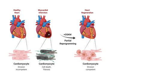 Heart regeneration after reprogramming of cardiac muscle cells