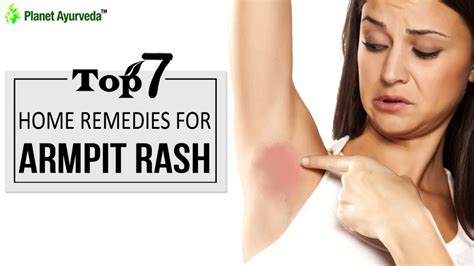 Top 7 Home Remedies for Armpit Rash