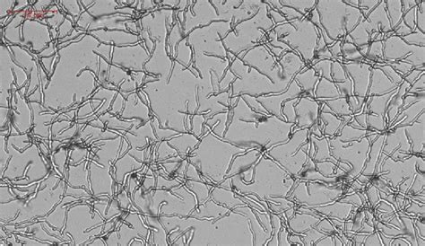 Fungal Spores Under Microscope