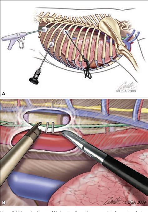 Figure 5 from Idiopathic chylothorax in dogs and cats: nonsurgical and surgical management ...