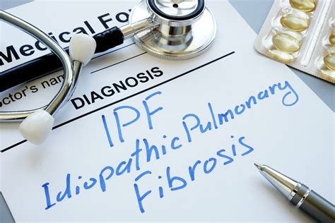 Potential IPF Treatment Shows Promising Results in Study - Rare Disease Advisor