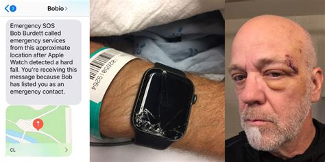 Apple watch saves biker's life by calling emergency services
