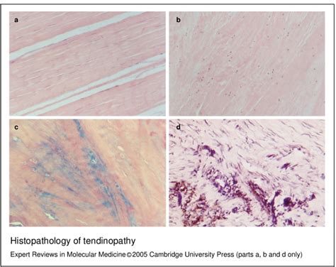 Histology Of Tendon