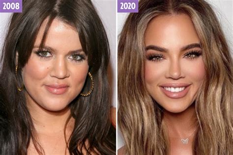 The ever-changing face of Khloe Kardashian… From awkward reality TV star to blonde bombshell ...