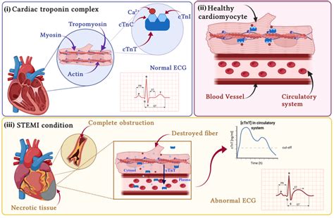 (i) Cardiac troponin complex is composed of three different protein... | Download Scientific Diagram