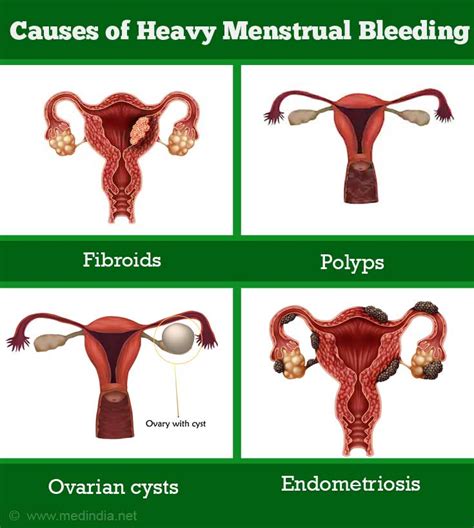 Death from excessive blood loss - Pictures