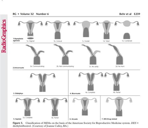 Nagendra's Radiology Blog: MULLERIAN DUCT ABNORMALITIES