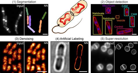 Microscopy preprints - Bioimage analysis tools