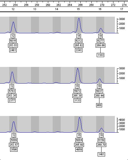 dna.reinyday.com - Genealogical DNA Testing - DYS464 Electropherogram Interpretation Discrepancy