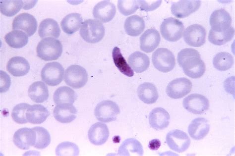 Free picture: blood smear, micrograph, plasmodium falciparum, parasite, microgametocyte