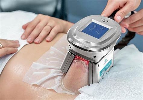 Expressions - Fat Freezing Treatment in Singapore - SHOPSinSG